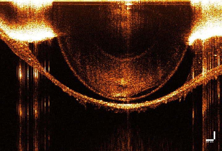 nkt oct system tomografia